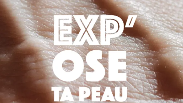 Exp’OSE TA PEAU : Un nouveau regard pour mieux vivre avec sa maladie de peau