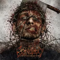 Craniotomy