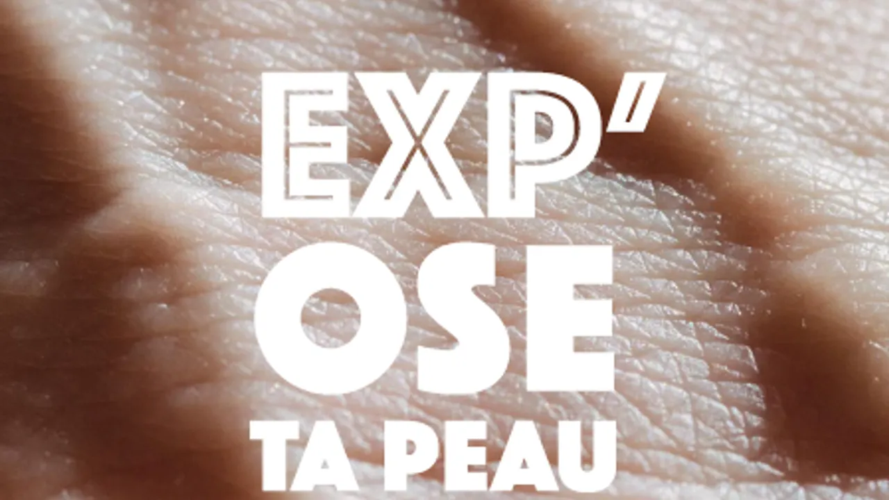 Exp’OSE TA PEAU : Un nouveau regard pour mieux vivre avec sa maladie de peau