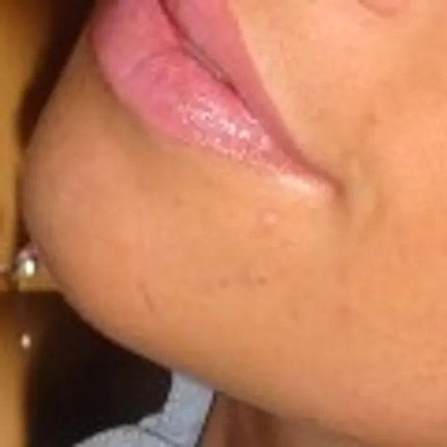 Popouet S
