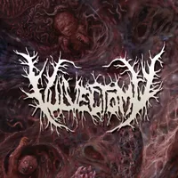 Vulvectomy