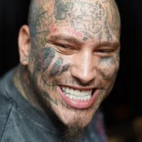 Stitches