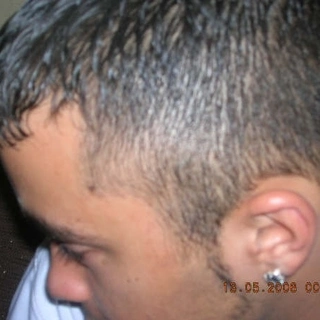 Allan L